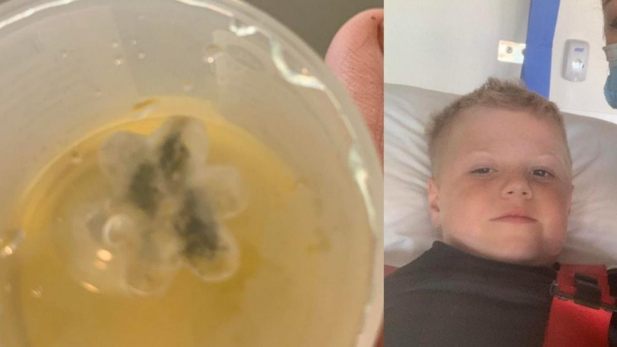 Noticia: Niño tuvo tos por cinco años debido a un juguete en su garganta Niño tuvo tos por cinco años debido a un juguete en su garganta