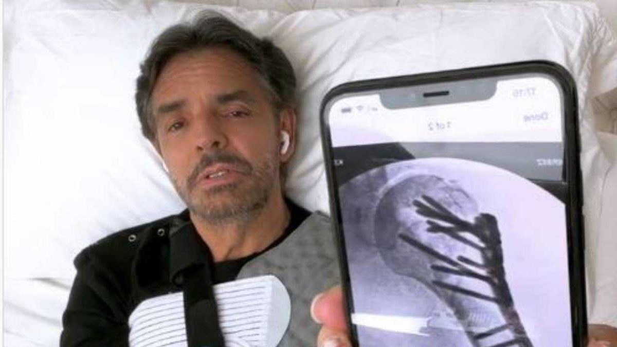 Noticia: Eugenio Derbez reapareció tras su cirugía y reveló los detalles de su accidente Eugenio Derbez reapareció tras su cirugía y reveló los detalles de su accidente