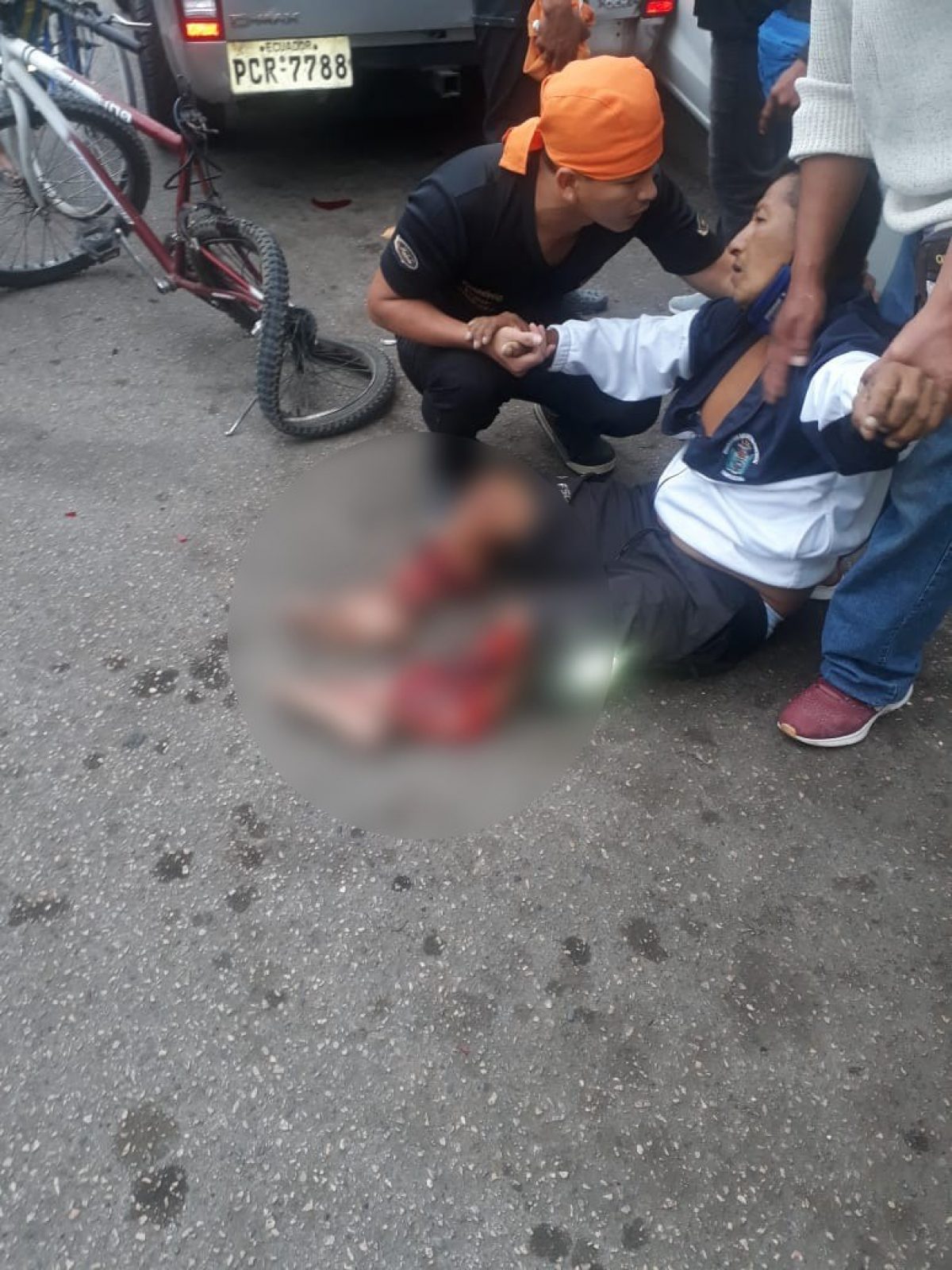 Noticia: ¡Terrible accidente! Carro destroza piernas de hombre que estaba en su bicicleta ¡Terrible accidente! Carro destroza piernas de hombre que estaba en su bicicleta