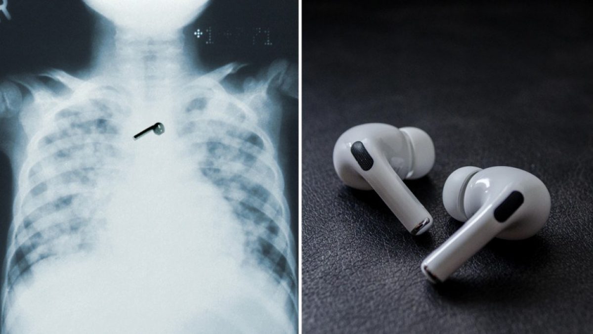 Noticia: Se quedó dormido y se tragó uno de sus AirPods Se quedó dormido y se tragó uno de sus AirPods