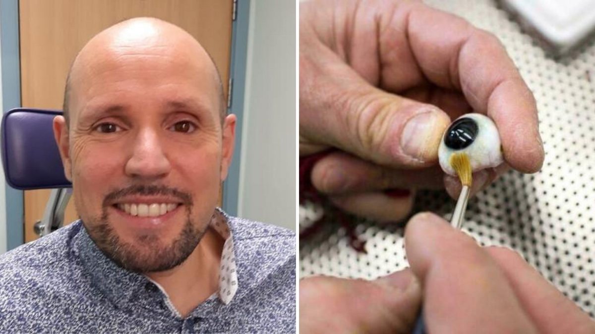 Noticia: Un paciente recibe la primera prótesis ocular impresa en 3D del mundo Un paciente recibe la primera prótesis ocular impresa en 3D del mundo