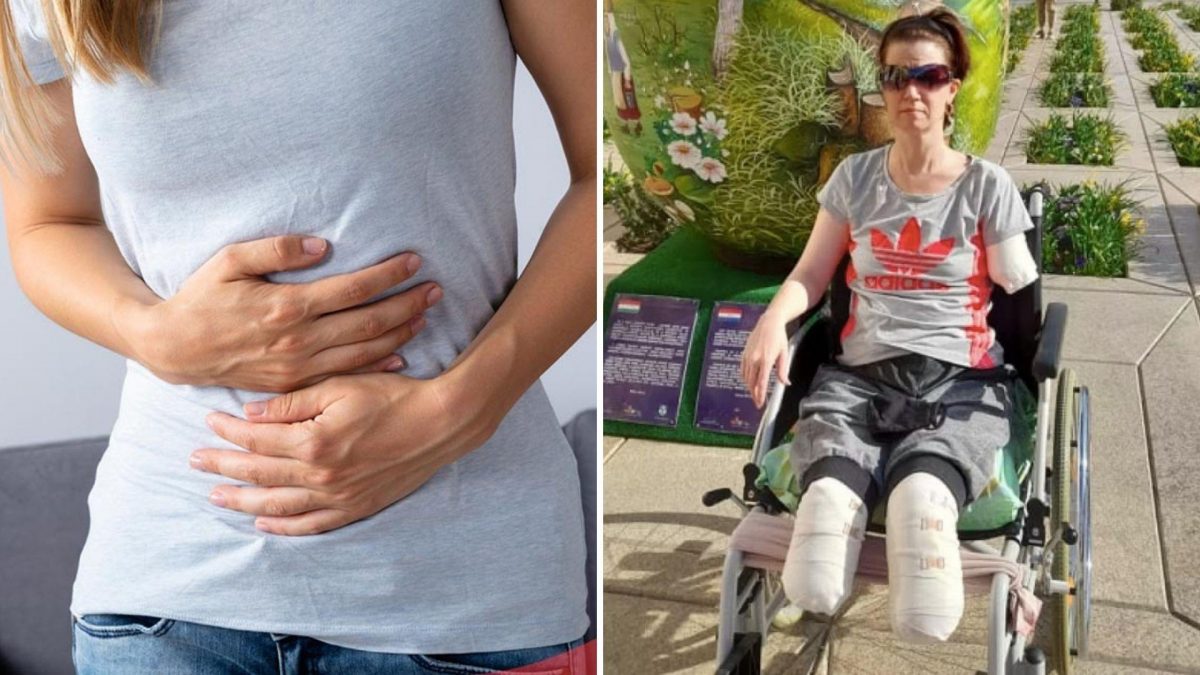 Noticia: Fue al hospital por un dolor de estómago y le amputaron ambas piernas y un brazo Fue al hospital por un dolor de estómago y le amputaron ambas piernas y un brazo