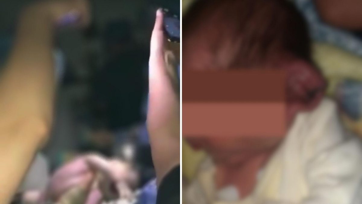 Noticia: Médicos realizaron cesárea con la linterna de los celulares y le cortaron la oreja al bebé Médicos realizaron cesárea con la linterna de los celulares y le cortaron la oreja al bebé