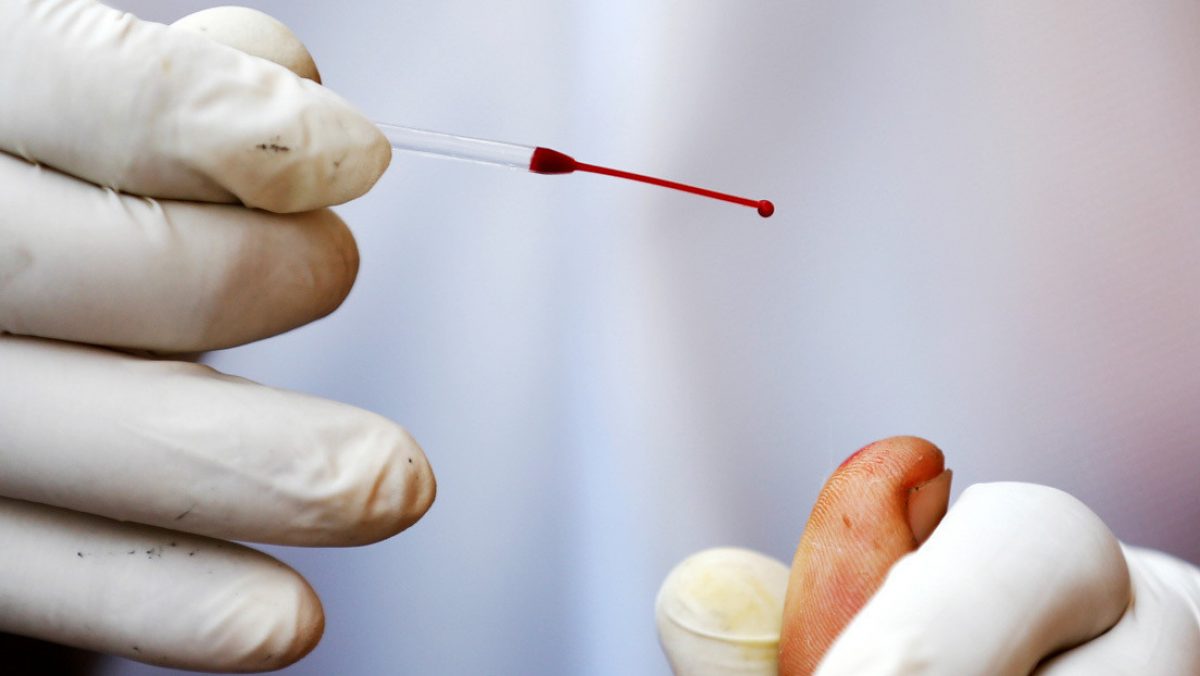 Noticia: Dio positivo 43 veces: un hombre sufrió una infección continua por Covid-19 Dio positivo 43 veces: un hombre sufrió una infección continua por Covid-19
