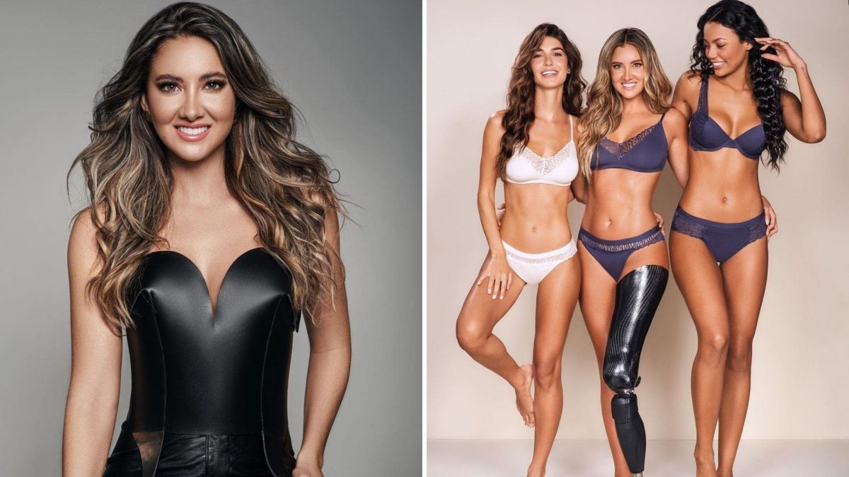 Noticia: Exreina de belleza que perdió su pierna quiere convertirse en madre Exreina de belleza que perdió su pierna quiere convertirse en madre