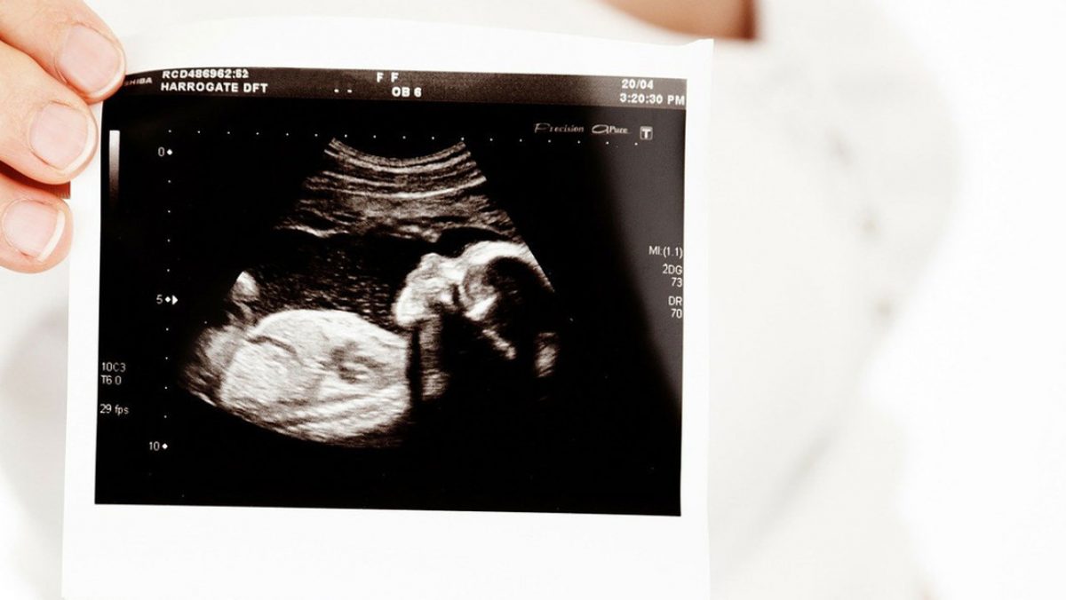 Noticia: Una bebé nace con una frondosa cabellera que ya era visible a las 34 semanas de embarazo (FOTOS, VIDEO) Una bebé nace con una frondosa cabellera que ya era visible a las 34 semanas de embarazo (FOTOS, VIDEO)