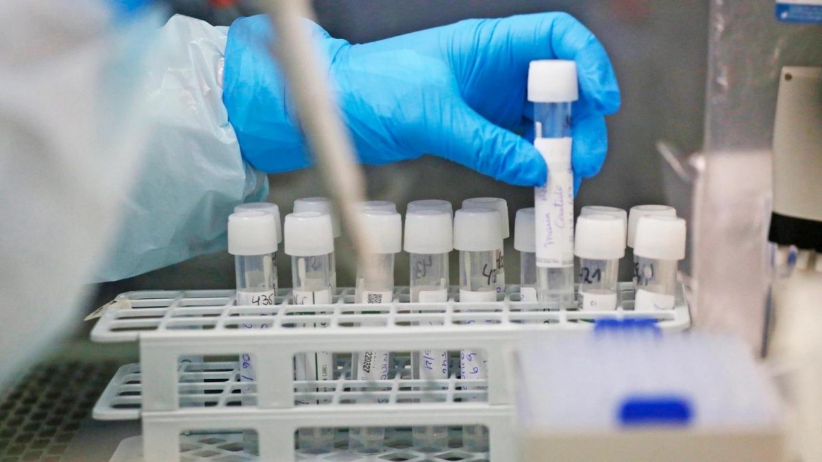 Noticia: Brasil monitorea 28 casos sospechosos de hepatitis infantil aguda Brasil monitorea 28 casos sospechosos de hepatitis infantil aguda