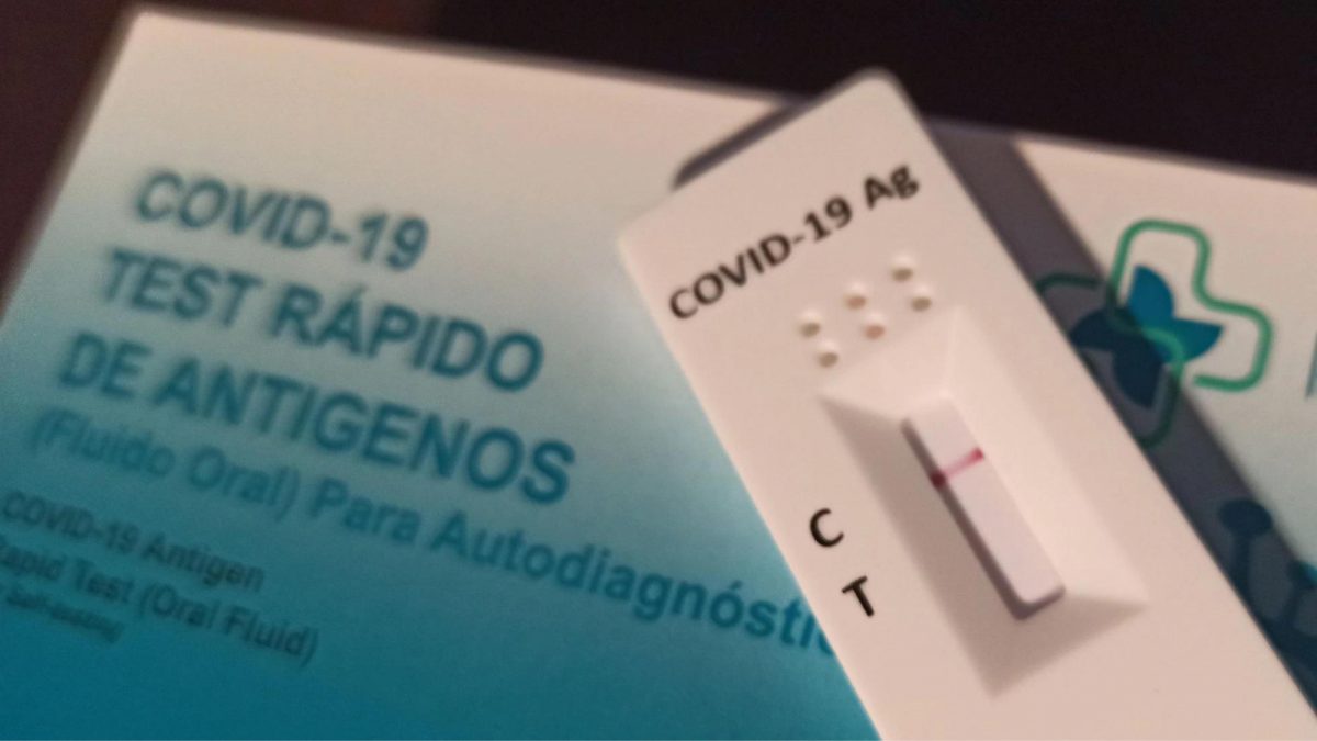 Noticia: Ecuador aprueba libre venta de pruebas de antígenos para detectar covid-19 Ecuador aprueba libre venta de pruebas de antígenos para detectar covid-19