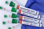 Noticia: Сonfirman segunda muerte por la viruela del mono en España Сonfirman segunda muerte por la viruela del mono en España