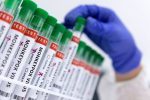 Estados Unidos intensifica la vacunación contra la viruela del mono