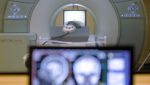 Noticia: Logran 'borrar' los recuerdos de miedo y aversión con estimulación transcraneal Logran 'borrar' los recuerdos de miedo y aversión con estimulación transcraneal