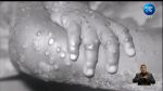 Imagen: Ministerio de Salud reportó un nuevo caso de la viruela del mono en el país Imagen: Ministerio de Salud reportó un nuevo caso de la viruela del mono en el país