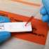VIDEO | Preocupación en Ecuador por posible rebrote de coronavirus