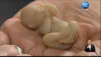 Noticia: ¿Qué significa la 'despenalización del aborto'? ¿Qué significa la 'despenalización del aborto'?