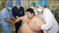 Noticia: Fotos | Un joven chino sube de peso 100 kilos durante el confinamiento Fotos | Un joven chino sube de peso 100 kilos durante el confinamiento