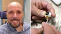 Noticia: Un paciente recibe la primera prótesis ocular impresa en 3D del mundo Un paciente recibe la primera prótesis ocular impresa en 3D del mundo
