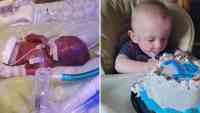 Noticia: El bebé más prematuro del mundo festejó su primer cumpleaños El bebé más prematuro del mundo festejó su primer cumpleaños