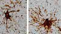 Noticia: Descubren en el cerebro "células zombis" Descubren en el cerebro "células zombis"