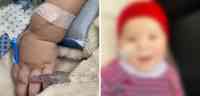Noticia: Ingresan de emergencia a niño que sufre de atrofia muscular Ingresan de emergencia a niño que sufre de atrofia muscular
