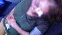 Noticia: Guayaquil: Tras secuestro mujer terminó con el rostro desfigurado y pulmón colapsado Guayaquil: Tras secuestro mujer terminó con el rostro desfigurado y pulmón colapsado