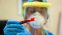 Noticia: España notifica 125 nuevos positivos de coronavirus y tan solo un fallecido en la última jornada España notifica 125 nuevos positivos de coronavirus y tan solo un fallecido en la última jornada