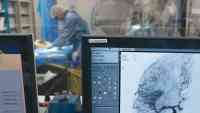 Noticia: Científicos detectan daños en vasos sanguíneos del cerebro de pacientes que murieron por covid-19 Científicos detectan daños en vasos sanguíneos del cerebro de pacientes que murieron por covid-19